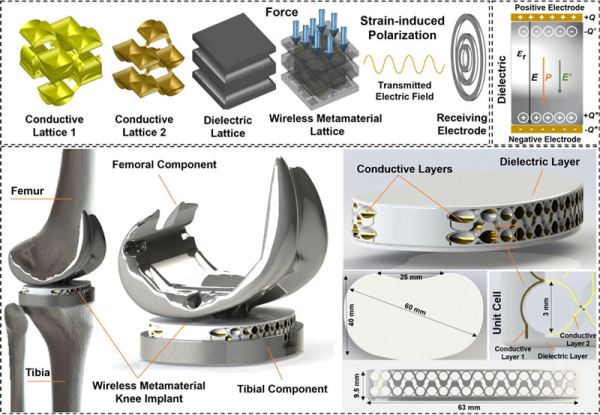 Инженеры-строители помогли создать первые в мире автономные датчики для лечения позвоночника